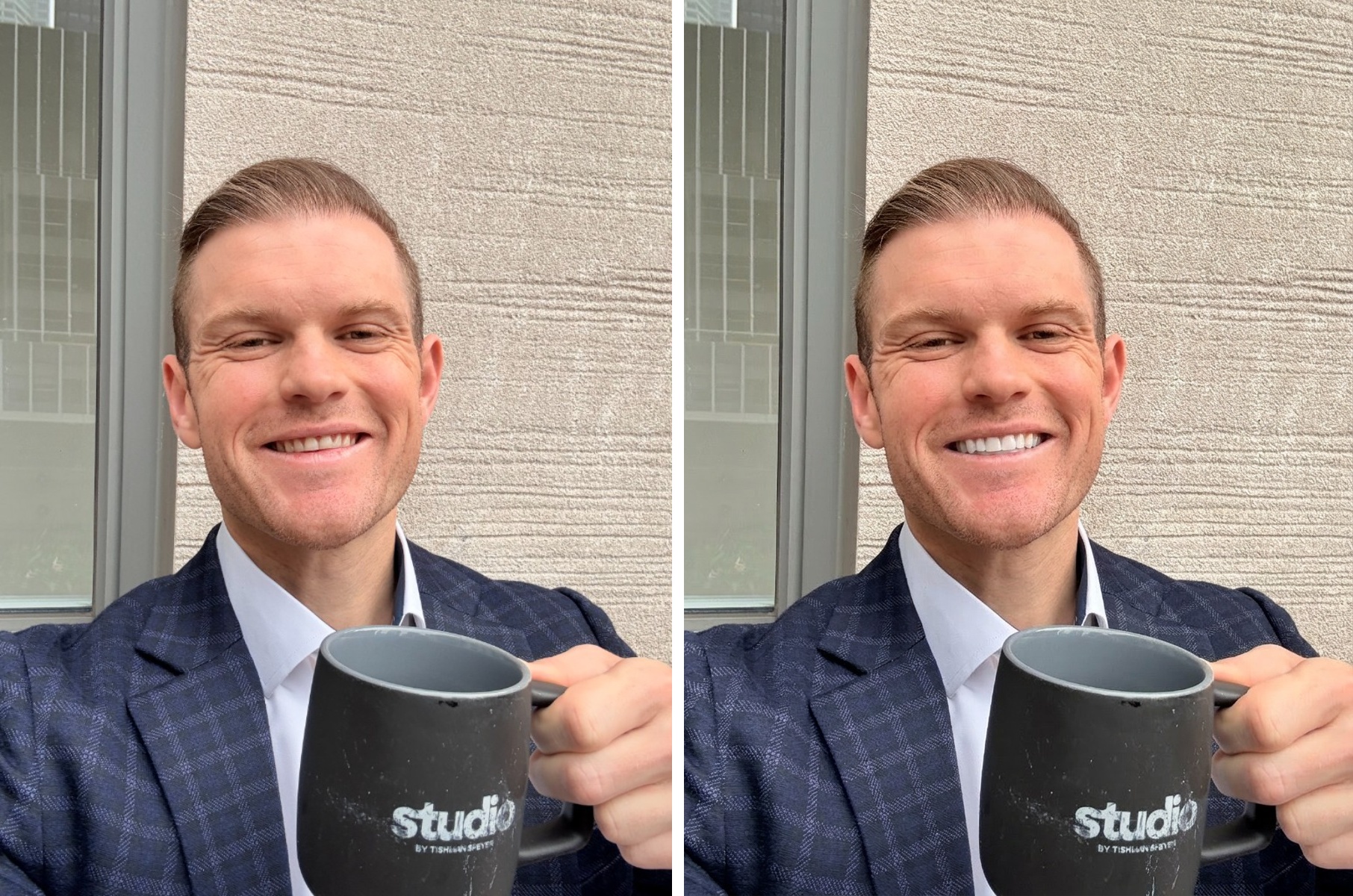 A real before and after smile rendered by Veneerly