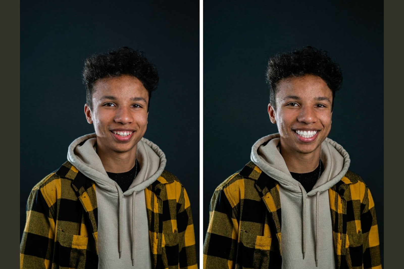 A real smile shown before and after veneers in a bright, broad style