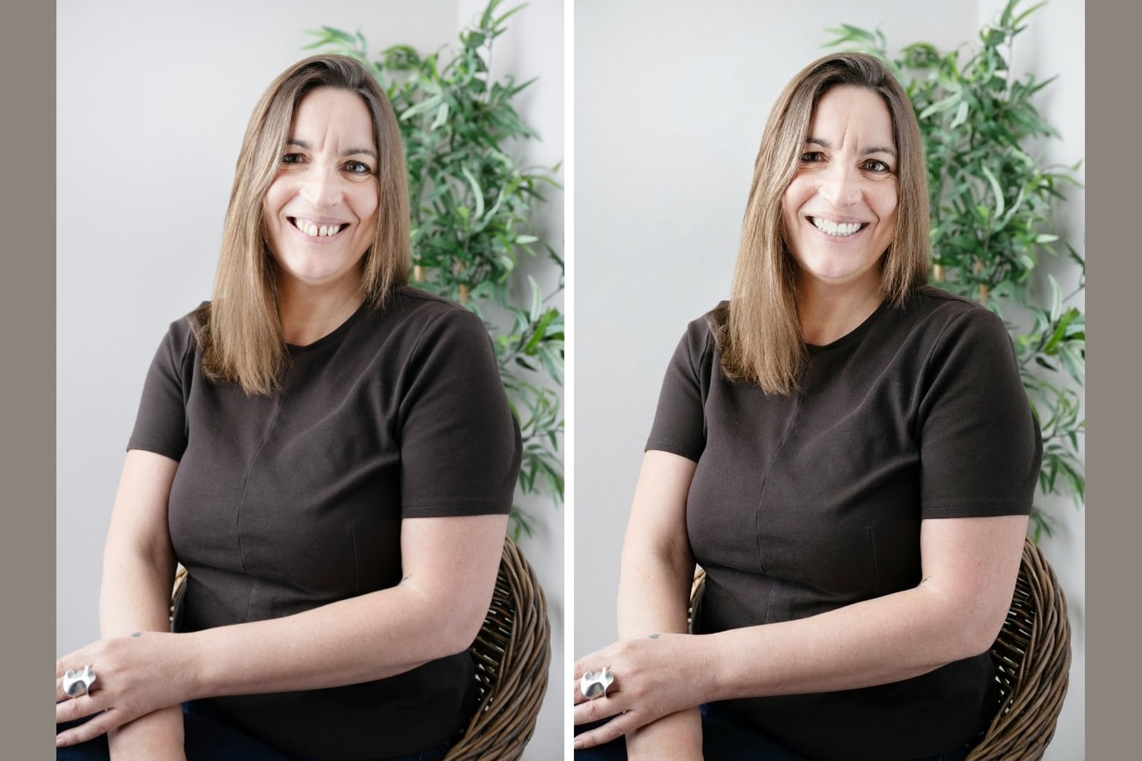 A real smile shown before and after veneers, illustrating veneers financing