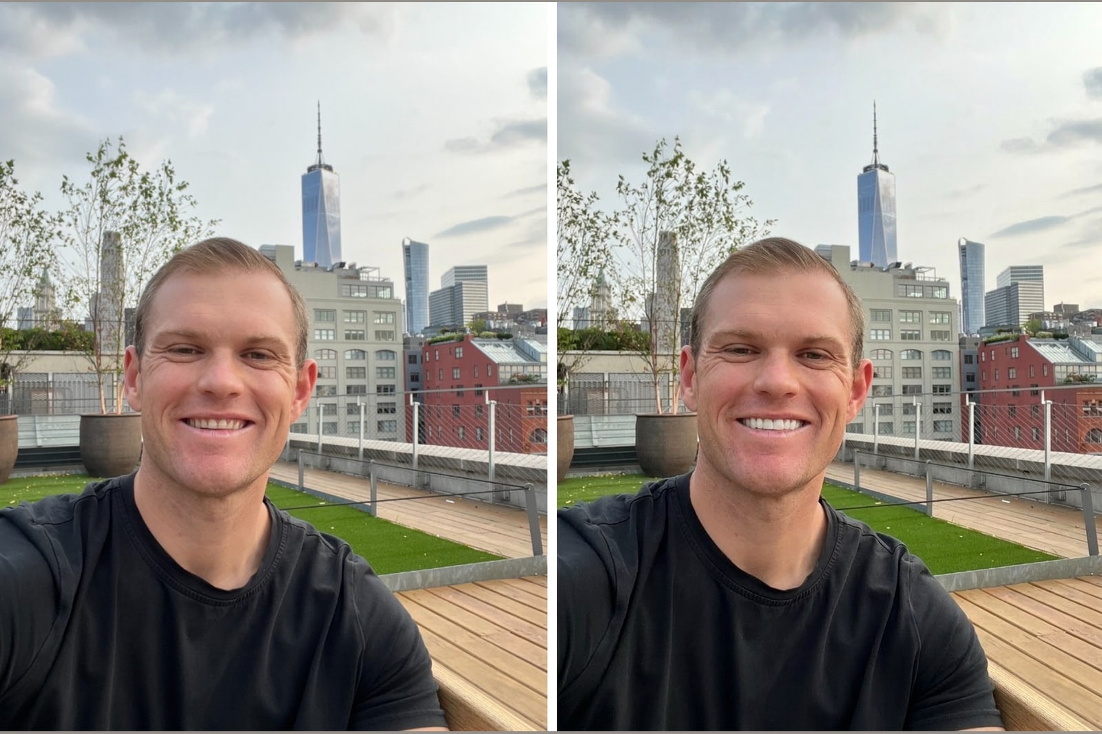 A real smile shown before and after veneers, illustrating veneers for gap teeth