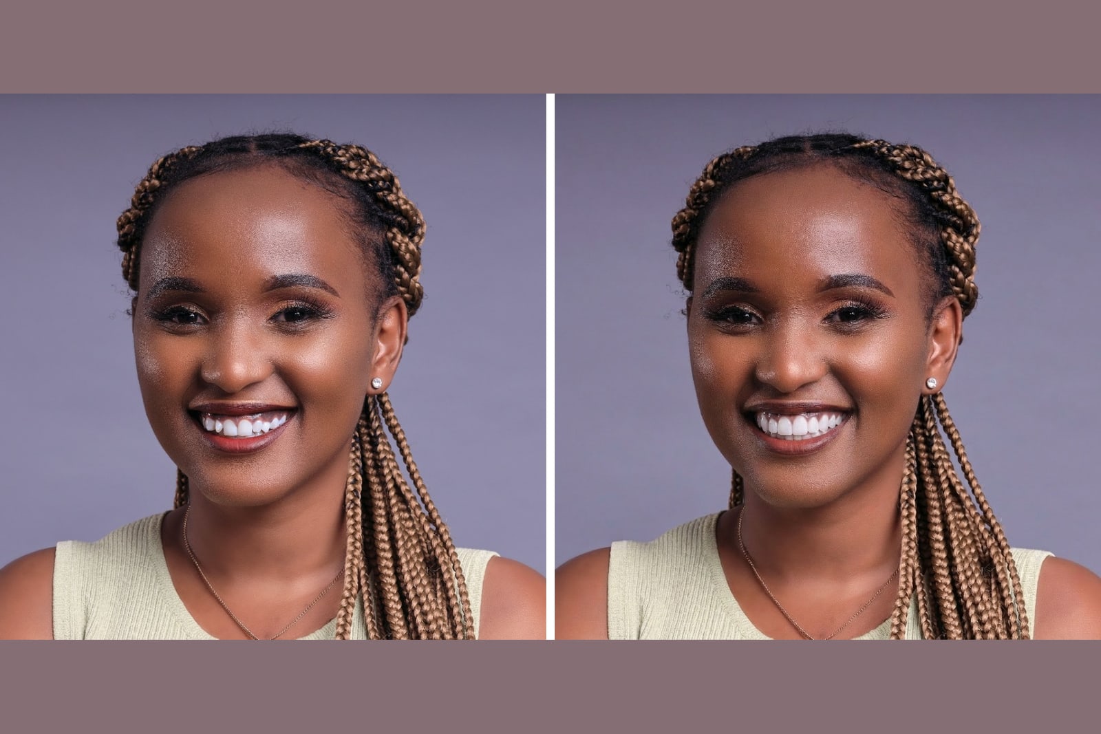 A real smile shown before and after veneers for veneers for gap teeth