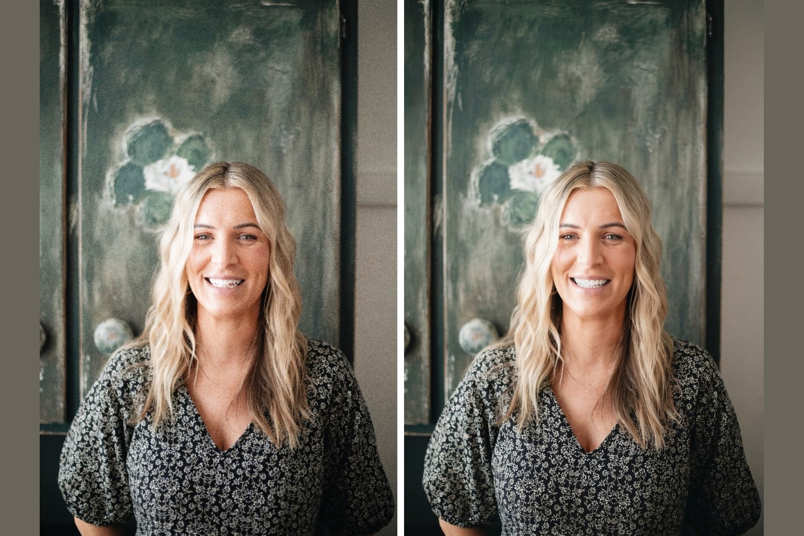 A real smile shown before and after veneers for veneers for stained teeth